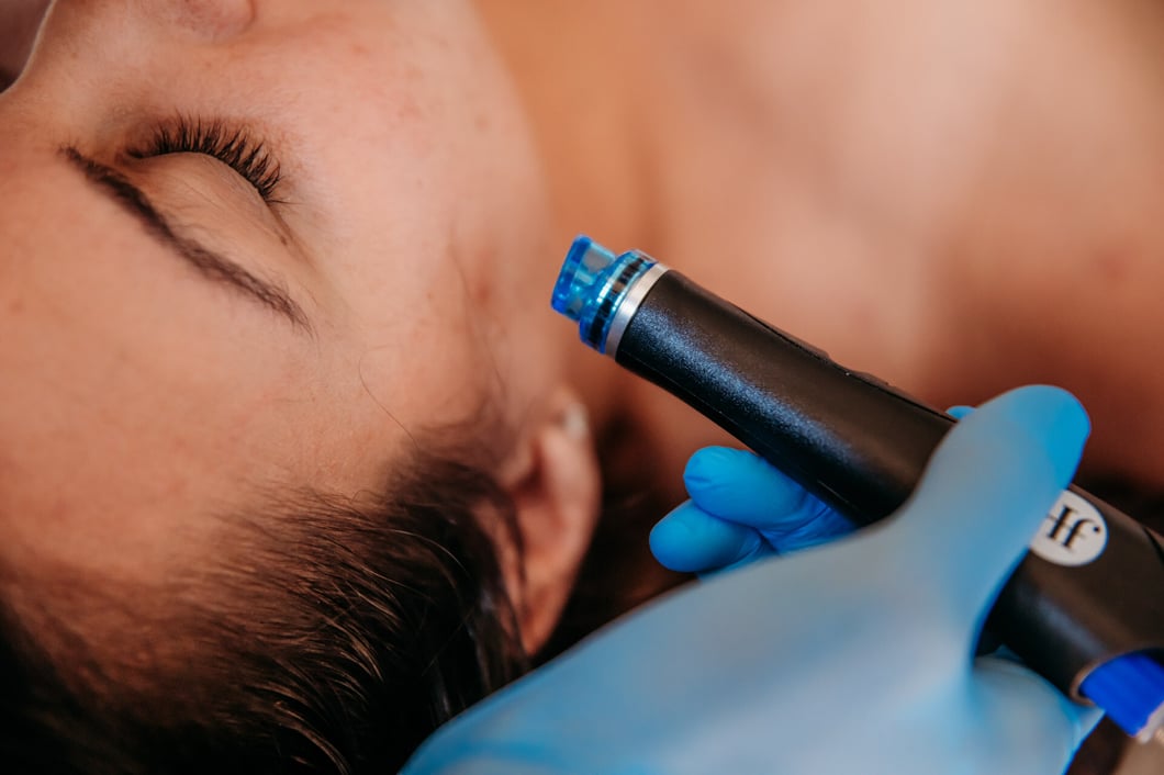 Bella_Collina_Spa_Hydrafacial-45